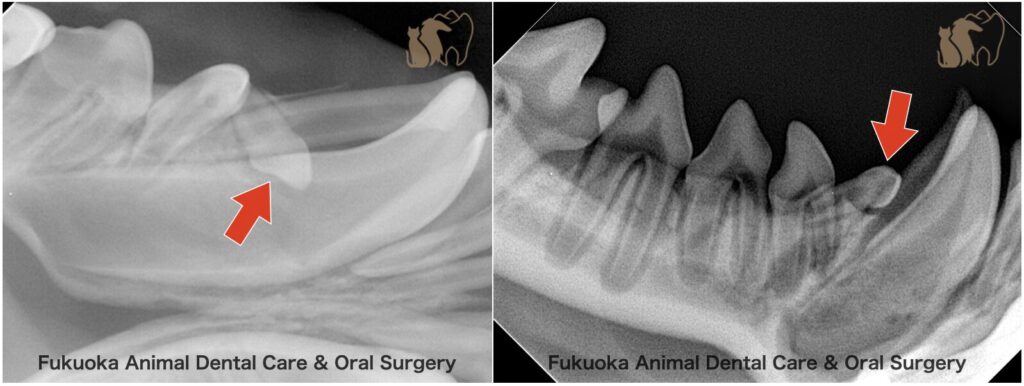 犬の避妊手術もしくは去勢手術を行なった際に歯科レントゲンを撮影した。萌出方向異常を原因とする埋伏歯の歯科レントゲン写真。