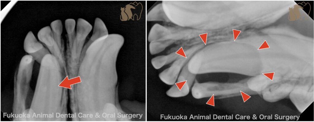 犬の含歯性嚢胞の歯科レントゲン写真。下顎犬歯の埋伏歯とそれに伴う含歯性嚢胞の所見。