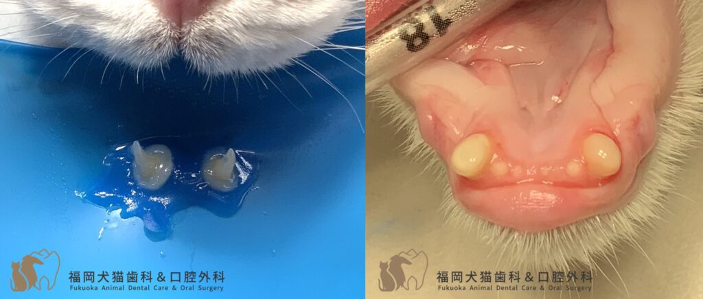 猫の下顎犬歯の歯冠短縮と抜髄。ラバーダム設置後に抜髄し、最後はコンポジットレジンで歯冠形態を整えた写真
