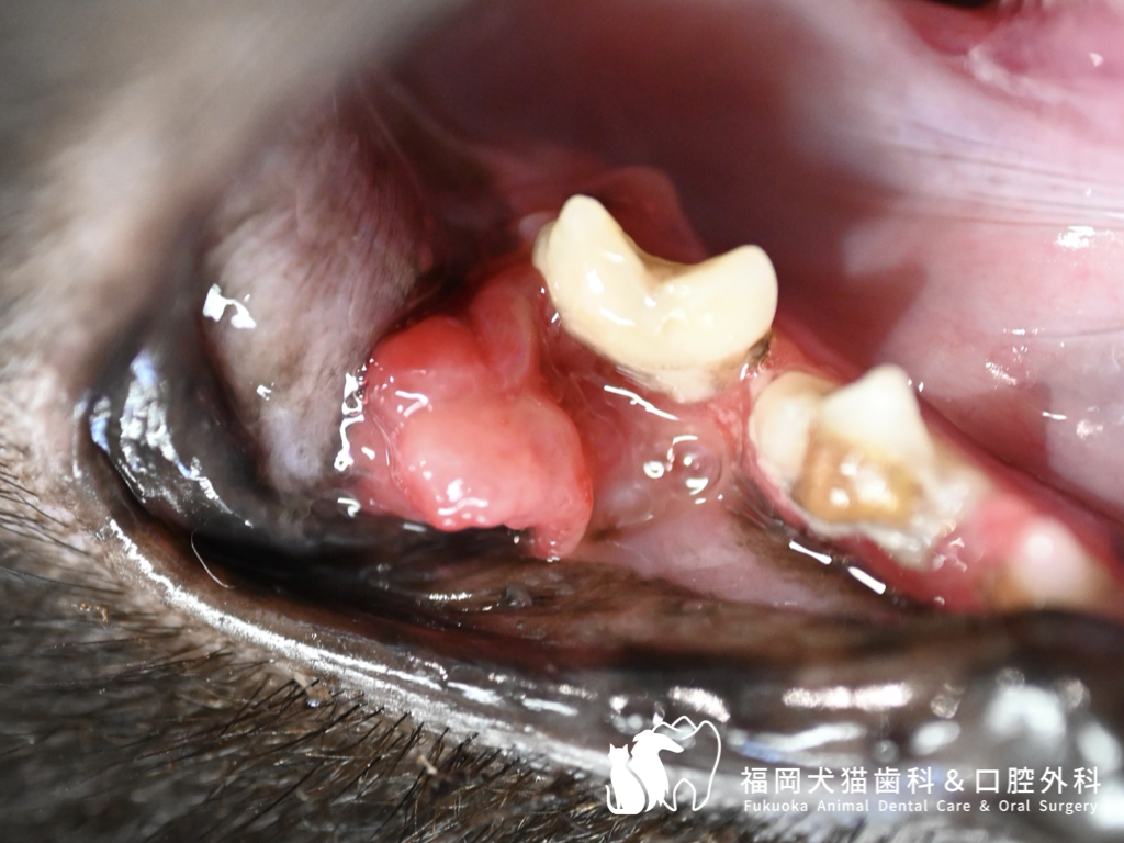 下顎の奥歯（第１後臼歯）の頬側にある腫瘤病変を示した口腔内写真